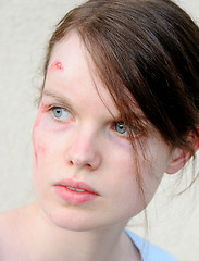 Image showing Injured woman 1