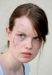 Image showing Injured woman 2