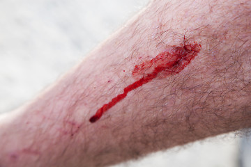Image showing Blood on a male leg. Injury, accident