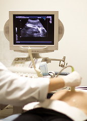 Image showing medical examining by ultrasonic scan