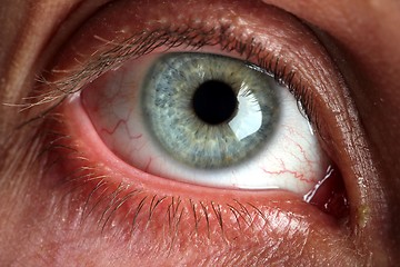 Image showing eyeball