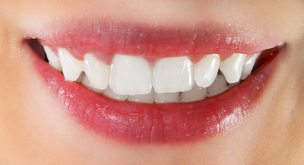 Image showing White healthy teeth