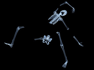 Image showing Shattered Skeleton