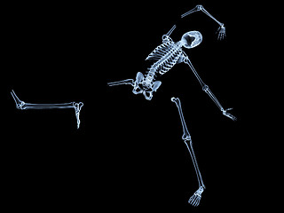 Image showing Shattered Skeleton