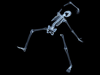 Image showing Shattered Skeleton