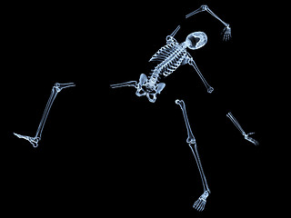 Image showing Shattered Skeleton