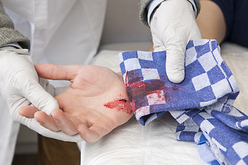 Image showing bleeding cut