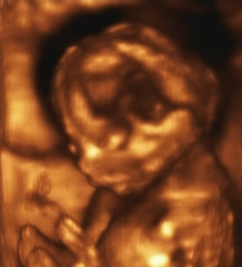 Image showing Ultrasonography Analysis of a 4th Month Fetus