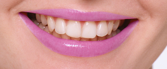 Image showing Close-up of female smile with healthy teeth