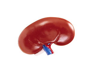 Image showing artificial kidney