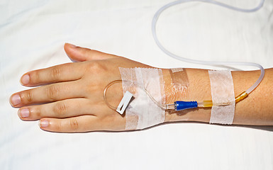 Image showing Medical intravenous cannula on hand