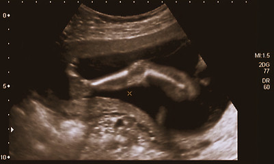 Image showing Ultrasonography Analysis of a 4th Month Fetus