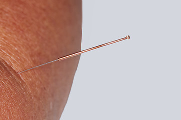 Image showing acupuncture 