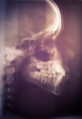 Image showing Human skull scan