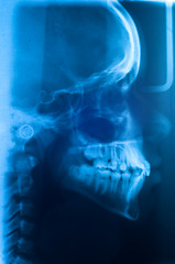 Image showing Human skull scan