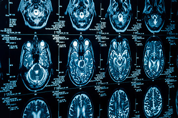 Image showing A group of CAT scans of the human brain