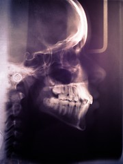 Image showing Human skull scan