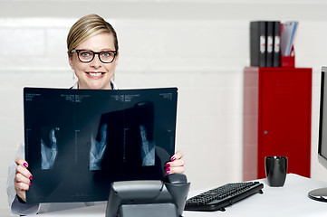 Image showing Female surgeon showing x-ray reports to camera