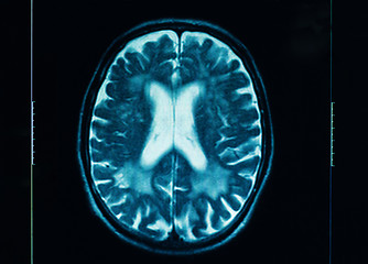 Image showing sharp ct scan of the human brain