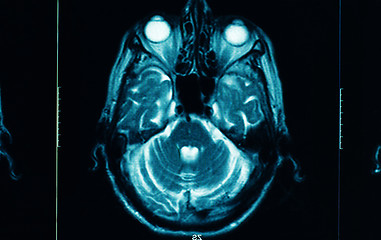 Image showing sharp ct scan of the human brain