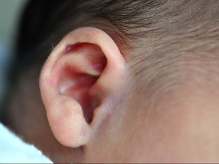 Image showing Newborn's Ear
