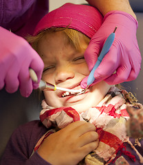 Image showing Child in pain at dentist