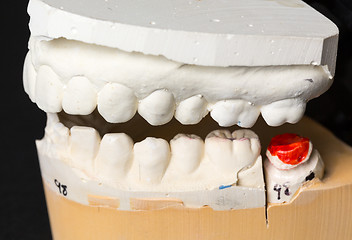 Image showing Mold of teeth taken for orthodontics