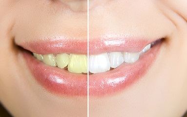 Image showing whitening