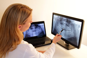 Image showing Dentistry explains a dental X-Ray 