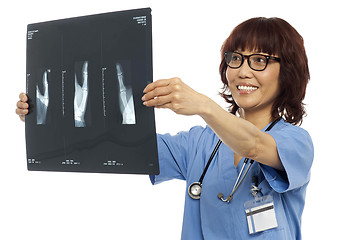 Image showing Female doctor reviewing x-ray report