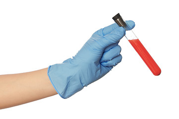 Image showing sample of bloods