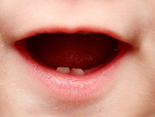 Image showing baby teeth