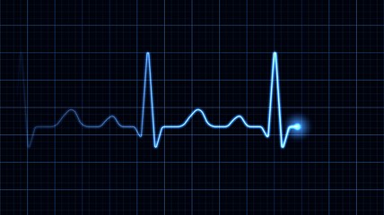 Image showing Electrocardiogram