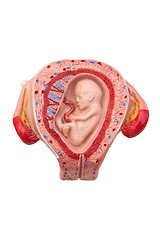 Image showing Pregnancy 3rd month