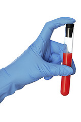 Image showing sample of bloods