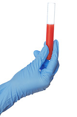 Image showing sample of bloods