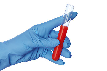 Image showing sample of bloods