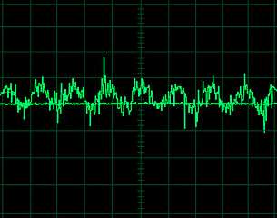 Image showing Oscillogram