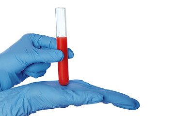 Image showing sample of bloods