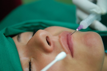 Image showing bottox beauty treatment