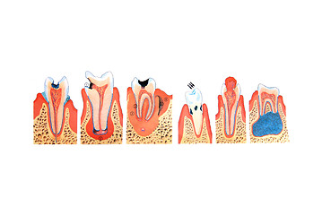 Image showing teeth illustration