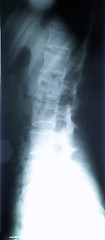 Image showing X-ray