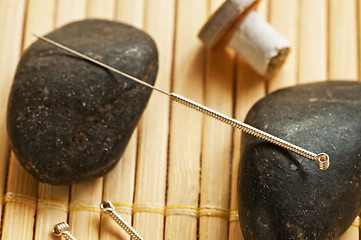 Image showing acupuncture needle