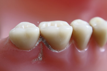 Image showing teeth problem 