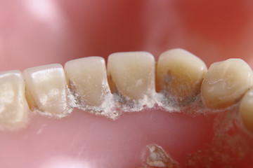 Image showing teeth problem 