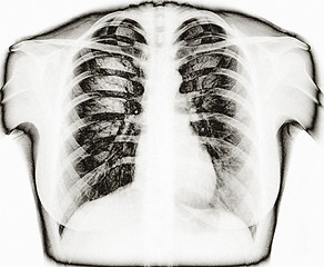 Image showing X-Ray Image Of Human Healthy Chest