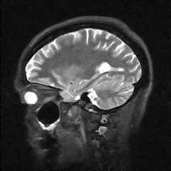 Image showing Magnetic resonance image of the human body. Head MRI or CT image