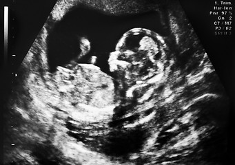 Image showing ultrasound of fetus