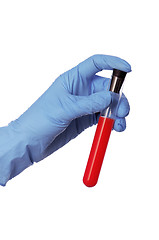 Image showing sample of bloods