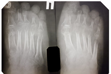 Image showing X-ray